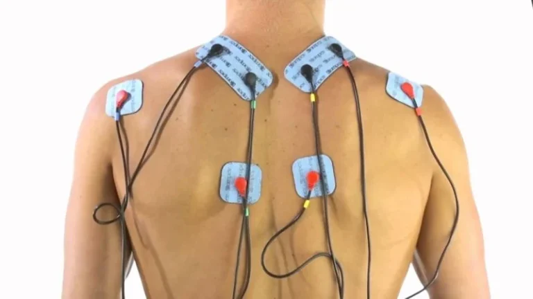 compex
