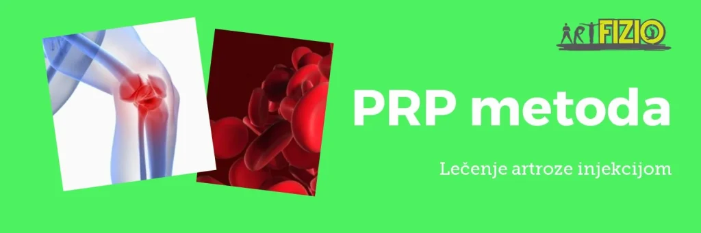 lecenje-artroze