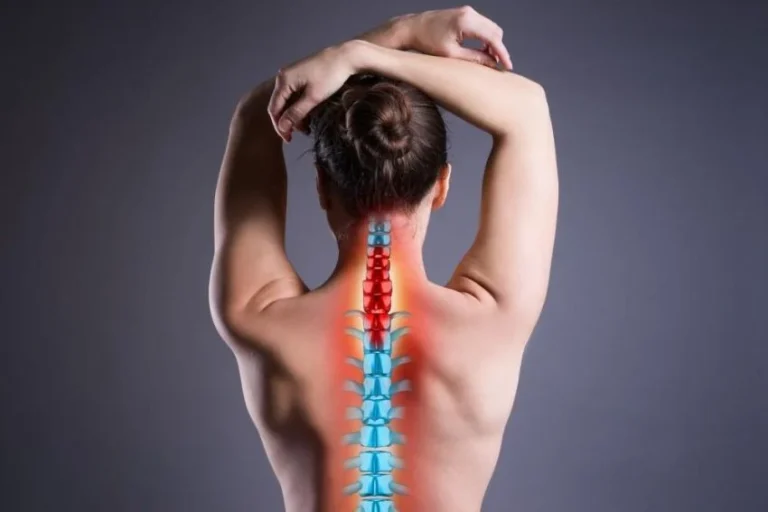 osteoporoza